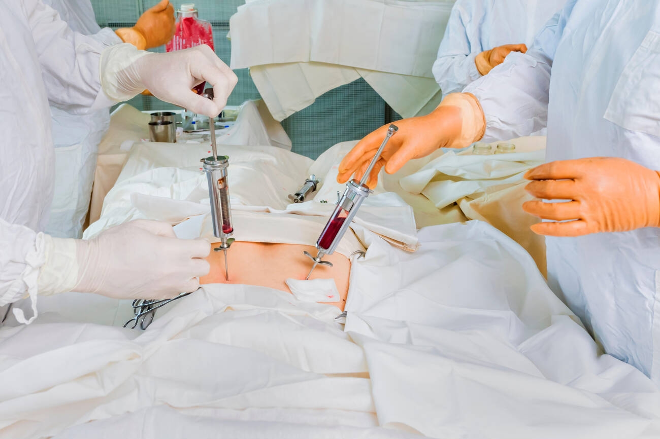 La clave para vencer la leucemia cómo el trasplante de médula ósea puede salvar vidas Clínica